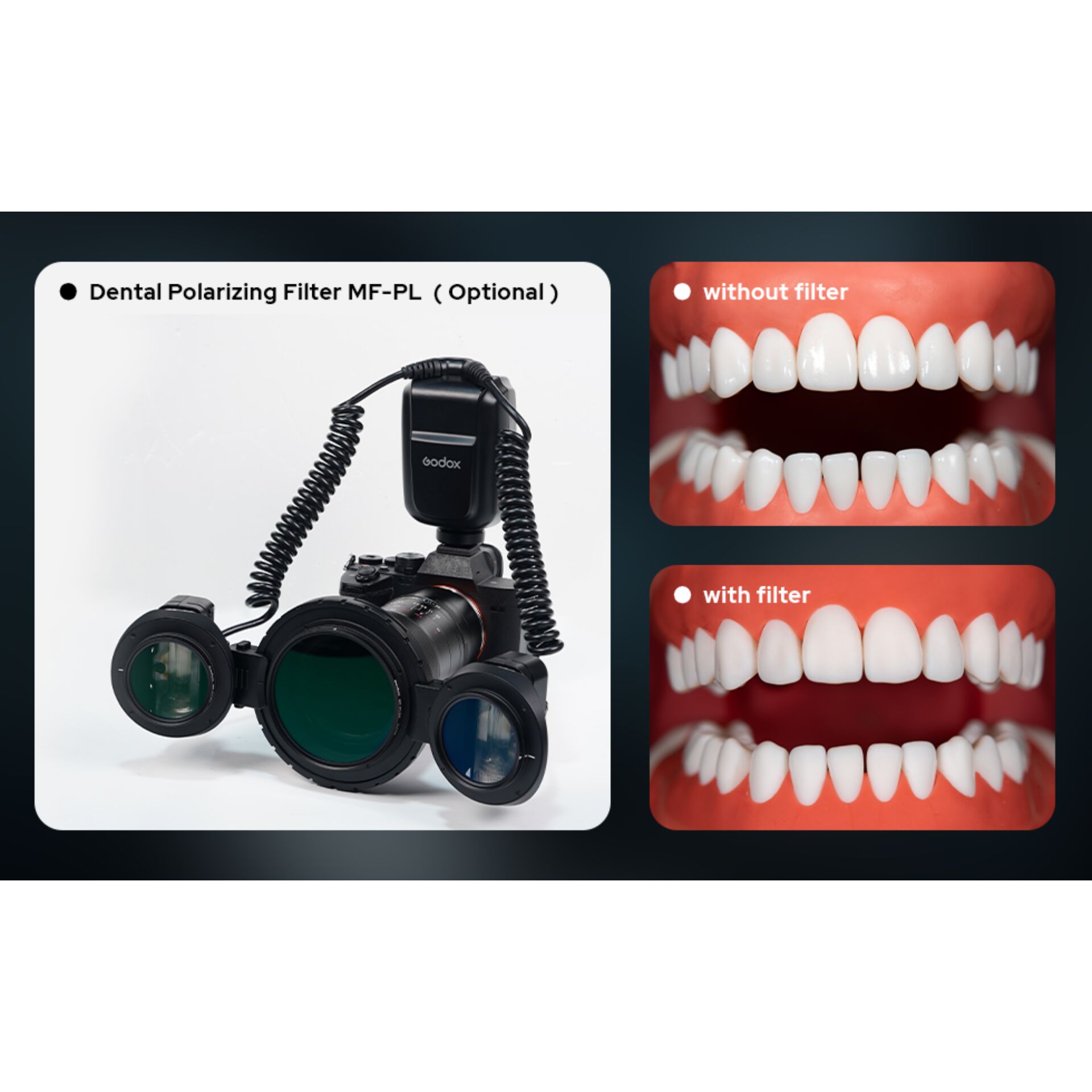 Godox MF-PL Dental Pol Filter für MF-T76